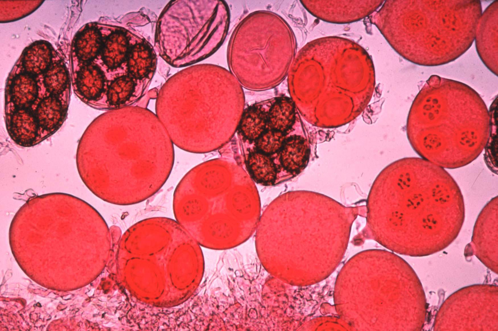 Tuber-aestivum Photograph through a microscope of tuber aestivum